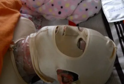 故意毁容要判多少年